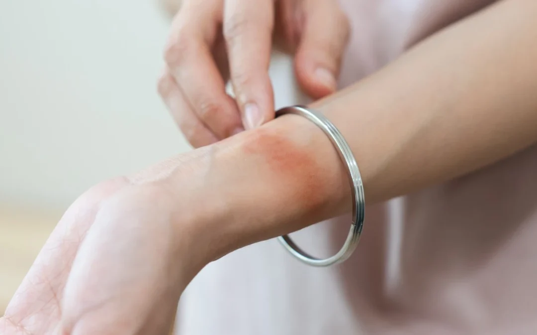 Hypoallergenic Jewellery: What Metals are Hypoallergenic and Best for Sensitive Skin