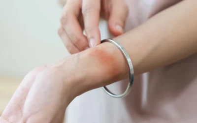 Home 3 Hypoallergenic Jewellery: What Metals are Hypoallergenic and Best for Sensitive Skin